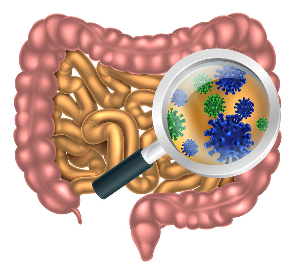 VSL3 acid colitis VSL3 acid colitis